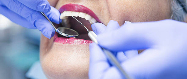 Best Emergency Dental Care for Abscessed Tooth in Colfax, CA